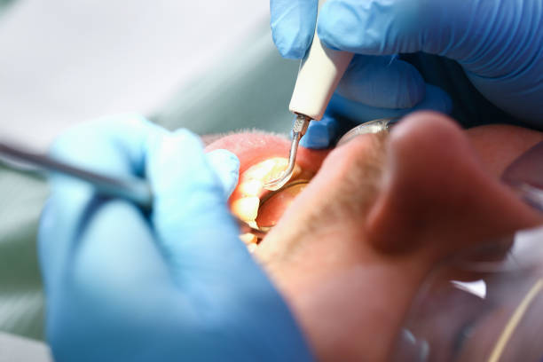 Best Urgent Dental Care for Toothache in Orange Cove, CA