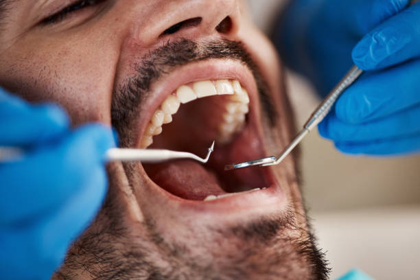 Best Emergency Dental Services for Seniors in Orange Cove, CA